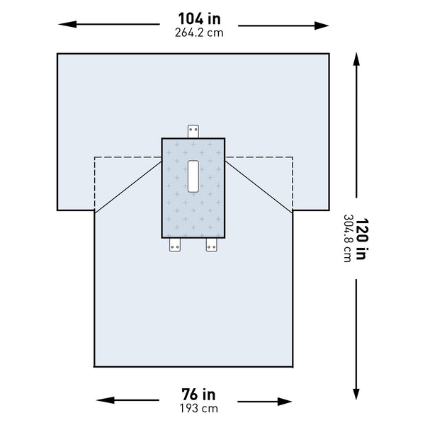 Abdominal Drape McKesson Laparotomy Drape 102 W X 76 W X 120 L Inch Sterile